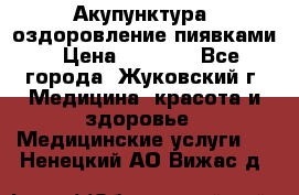 Акупунктура, оздоровление пиявками › Цена ­ 3 000 - Все города, Жуковский г. Медицина, красота и здоровье » Медицинские услуги   . Ненецкий АО,Вижас д.